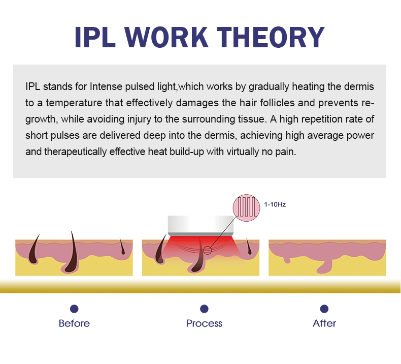 Opt IPL+Elight+RF Multifunctional IPL Hair Removal Opt Shr IPL Laser Hair Removal Machine