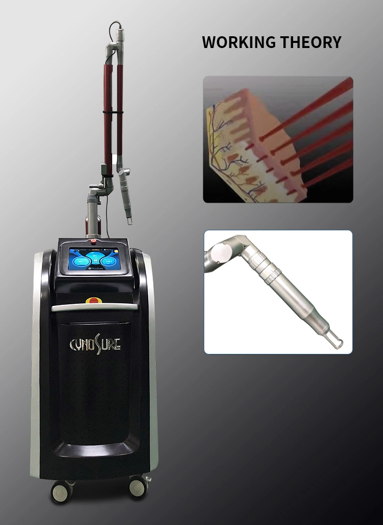 Imported Picosecond Laser Arm Tattoo Removal Dark Spot Removal Beauty Machine