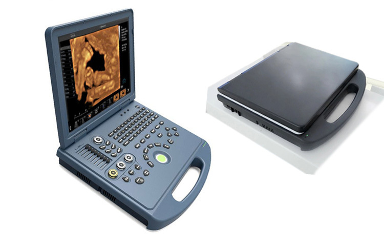 Medical Pregnancy Diagnosis Equipment Ultrasound Scanner
