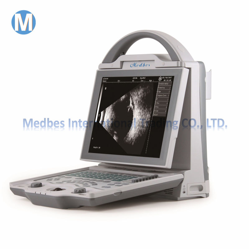 China Lowest Price Ophthalmic Ultrasound a B Scan Medical Equipment