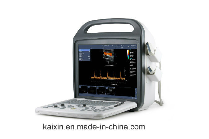 Battery Portable Durable, Functional Color Doppler Ultrasound Scanner