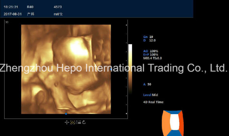 Digital Portable 4D Ultrasound Scanner for Echo Cardiac