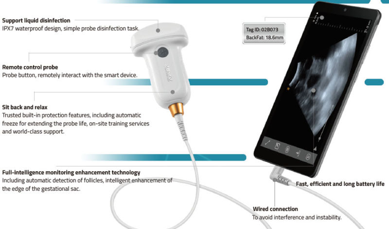 2D B Ultrasound Scanner USB Ultrasound Scanner Echograph Diagnosis System