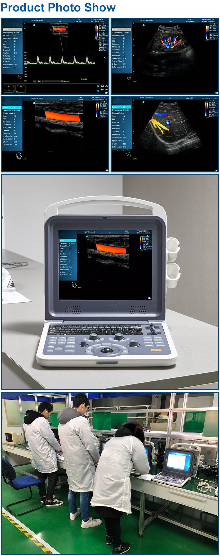 IN-AK0 China Portable Vet Doppler Ultrasound Machine Scanner Price
