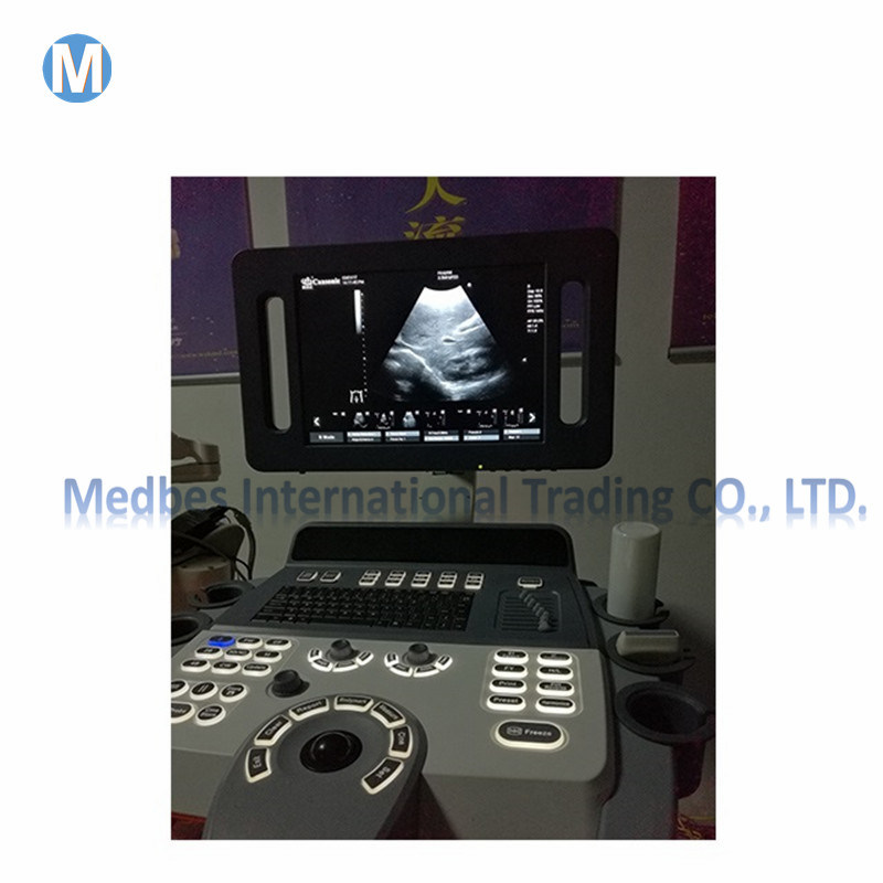 Portable Ultrasound Bladder Scanner Trolley Bladder Scanner Price