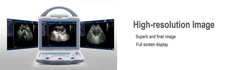 Portable 4D Ultrasound Scanner, 4D Fetus Ultrasound Scanning, Pregnancy Ultrasound Scanning Equipment, Ultrasound