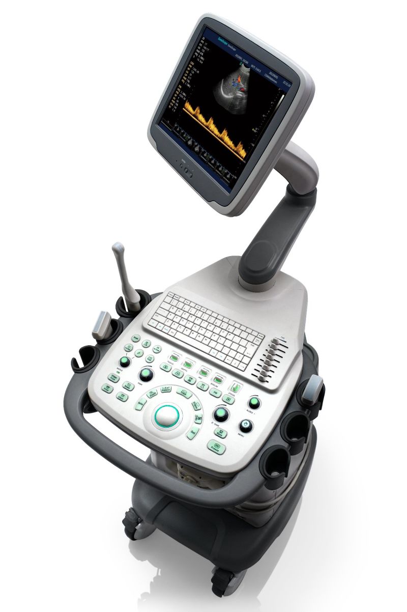 Sonoscape-S11 All-Round Scanner Portable 4D Color Doppler Ultrasound Scanner