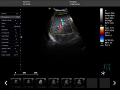 Qualified Cost-Effective Medical Device Ultrasound Machine Scanner