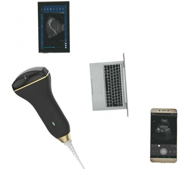 Android Phone/Tablet Doppler Probe Ultrasound Scanner, Doppler Ultrasound Price