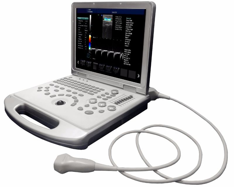 Medical Equipment 3D 4D Color Doppler Ultrasonic Equipment Ultrasound Machine