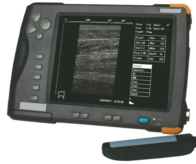 Farmscan Vet Ultrasound Scanner for Pig, Sheep Pregnancy Detection Pig Ultrasound Scanner Machine