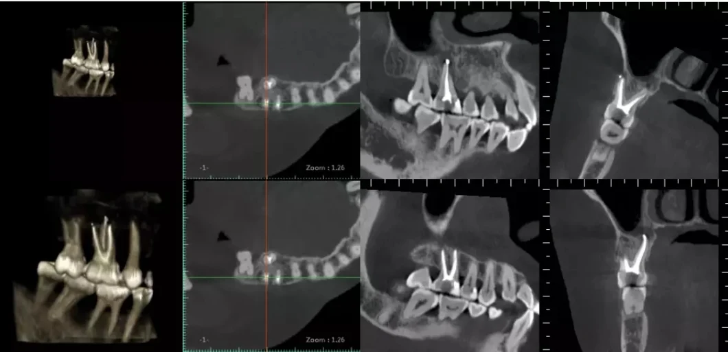 Hires3d-Max High-Ending Dental CT Scan The Largest Professional X-ray Dental Cbc