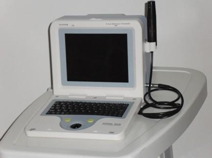 Ophthalmic Ultrasonic Ascan and B Scan and Ab Scan