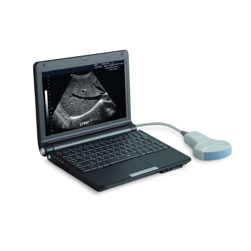 B/W Ultrasound Machine, Portable Digital Ultrasound Machine, Ultrasound Scanner Mslpu06