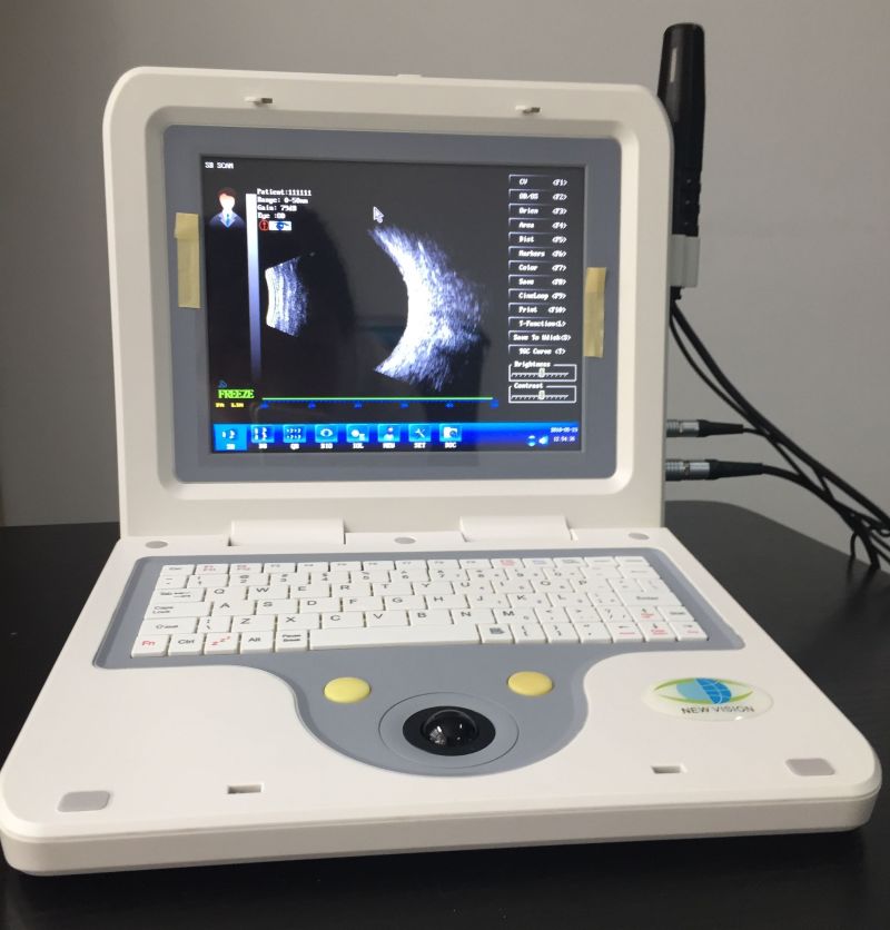 Ophthalmic Ultrasonic Ascan and B Scan and Ab Scan