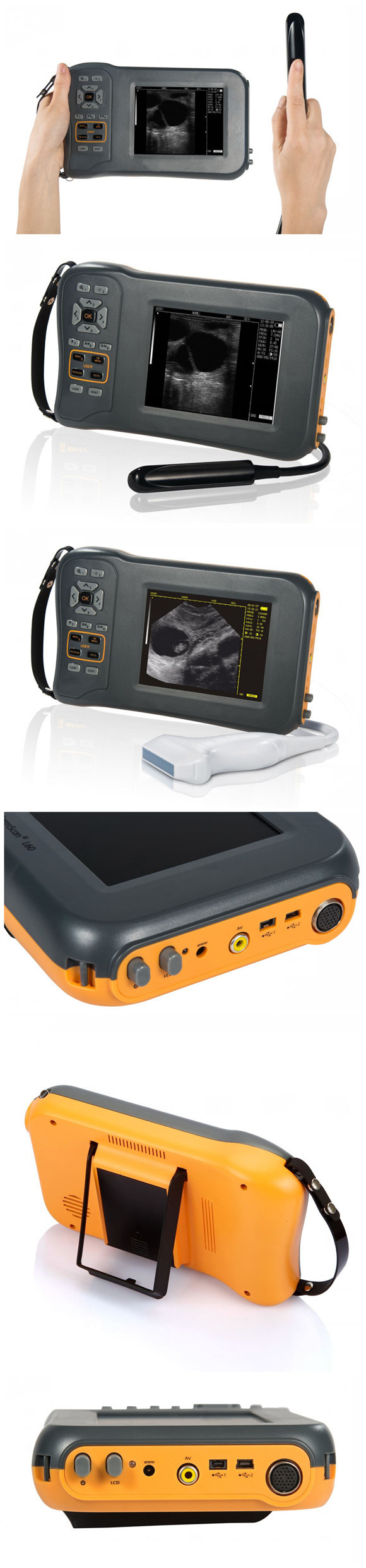 Medical Equipment Portable Handhelld Pet Veterinary Ultrasound Scanner/Machine for Vet