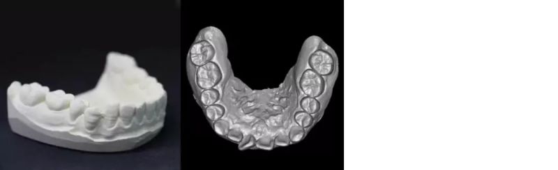 Hires 3D-Max Dental Panoramic Imaging Cbct Scanner Dental Xray Scan
