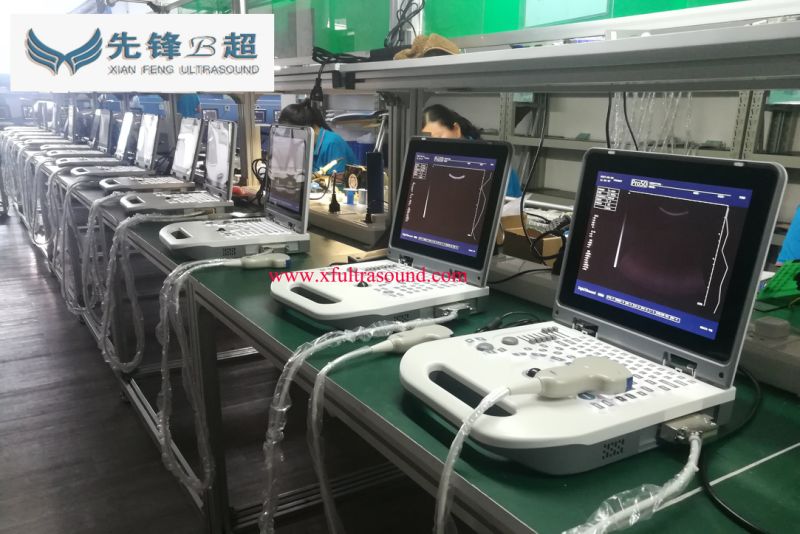 Laptop Full Digital Ultrasound Diagnostic Scanner Equipment