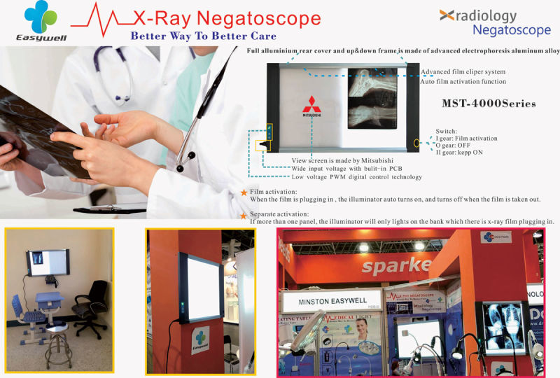LED X-ray Viewer Mst-4000II Double Unions with Mobile Base X-ray Negatoscope