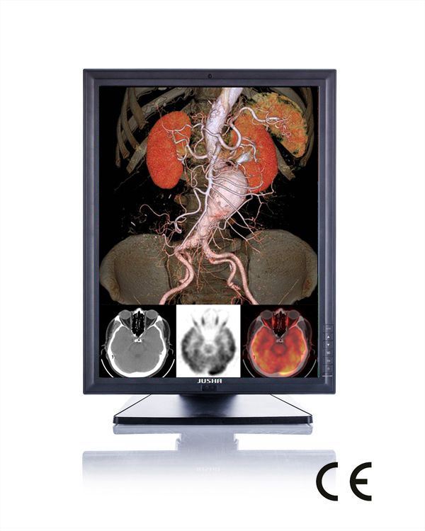 2MP X Ray Equipment, Ce 1600X1200 LED Screen Color Monitor