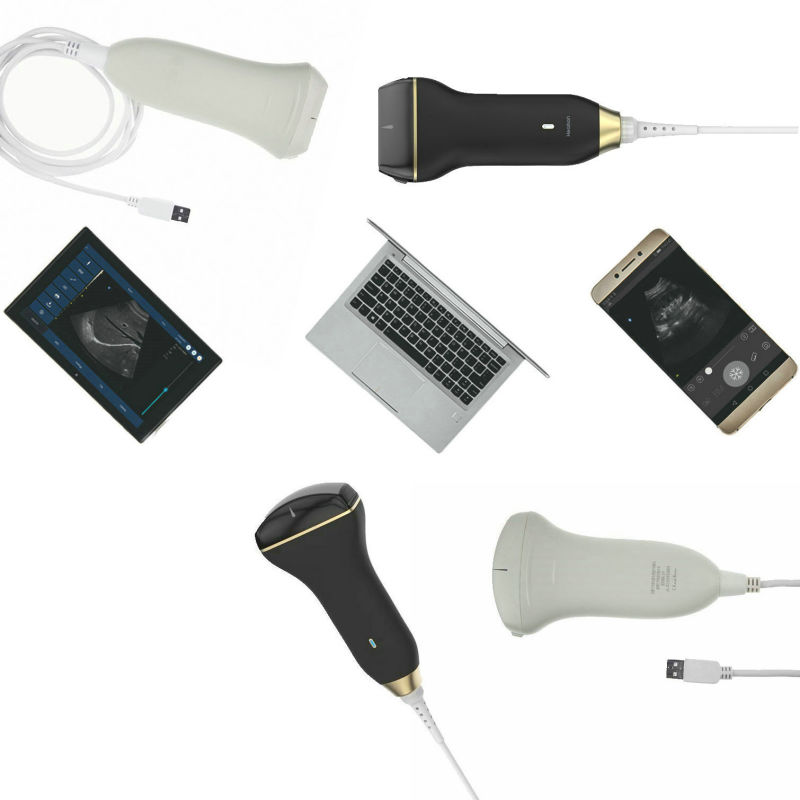 Best Price USB Probe Ultrasound Doppler Scanner Pocket Ultrasound Scanner