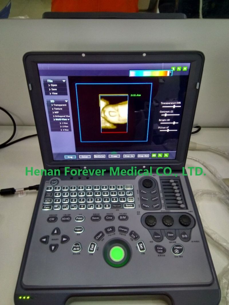 Ce ISO Approved Portable Laptop 4D Full Digital Color Doppler Ultrasound Scanner for Pregnant (YJ-C60)