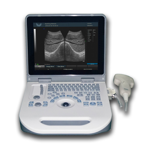 Laptop Full Digital Ultrasound Diagnostic Scanner Equipment