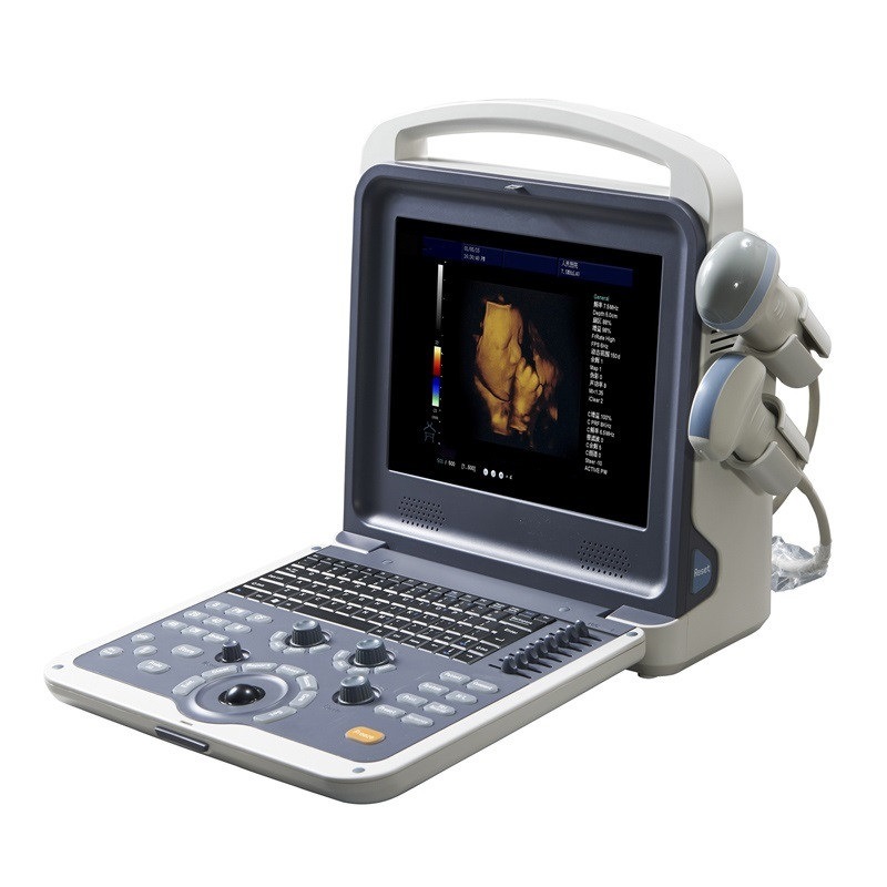 Portable Ultrasound Bladder Scanner Trolley Bladder Scanner Price