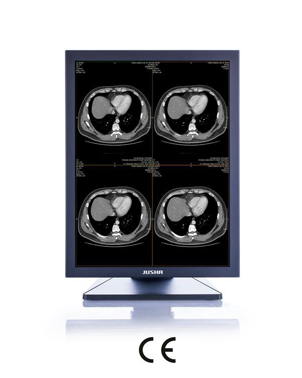 2MP 21-Inch 1600X1200 LED Screen Monochrome Monitor, CE Approved, X Ray Scanner