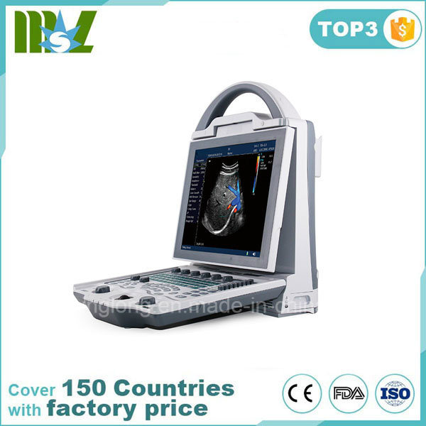 2018 New Portable Ophthalmic Ultrasound Scanner a/B Scanner for Ophthalmic Purpose Mslpu23