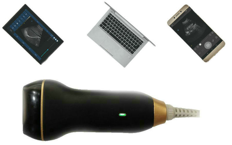 Best Price USB Probe Ultrasound Doppler Scanner Pocket Ultrasound Scanner