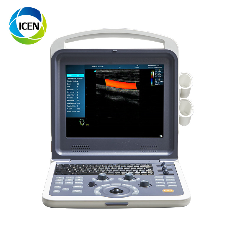 IN-AK0 China Portable Vet Doppler Ultrasound Machine Scanner Price