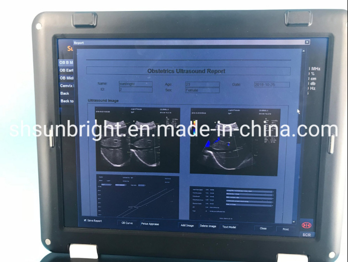 Ultrasound Scanner Machine Doppler 4D Scan Fetal Image Medical Scanner