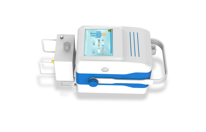 2018 New Technical Portable Digital X-ray /Cheaper X-ray Machine (MSLPX07)