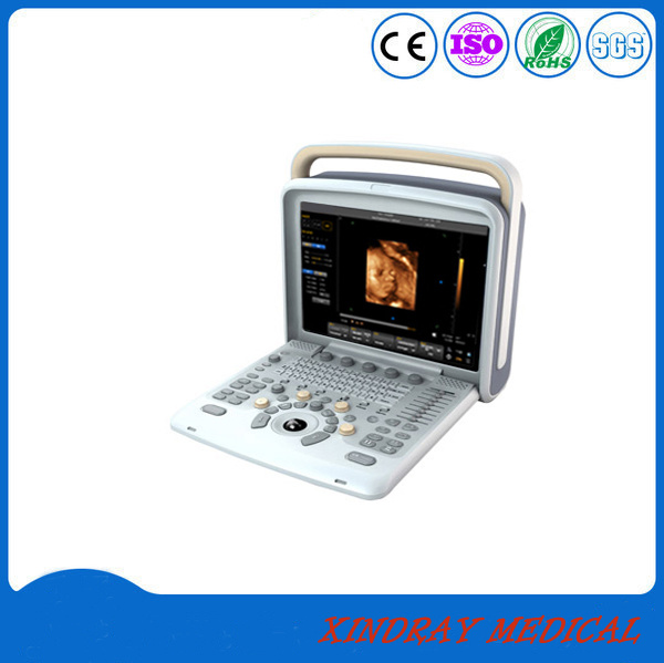 Hospital Equipment Digital Portable Palmtop Ultrasound Scanner