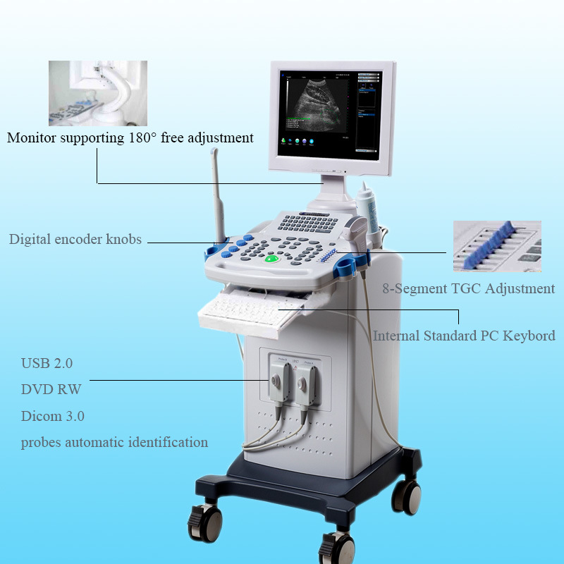 Trolley 3D Color Doppler Ultrasound Scanner Ultrasonic Scanner