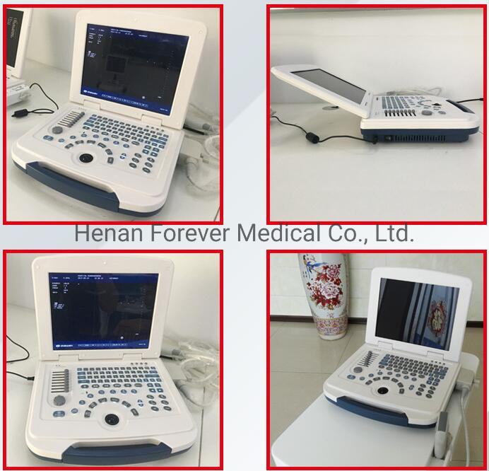 Medical Laptop B/W Portable Ultrasound Scanner for Abdomen