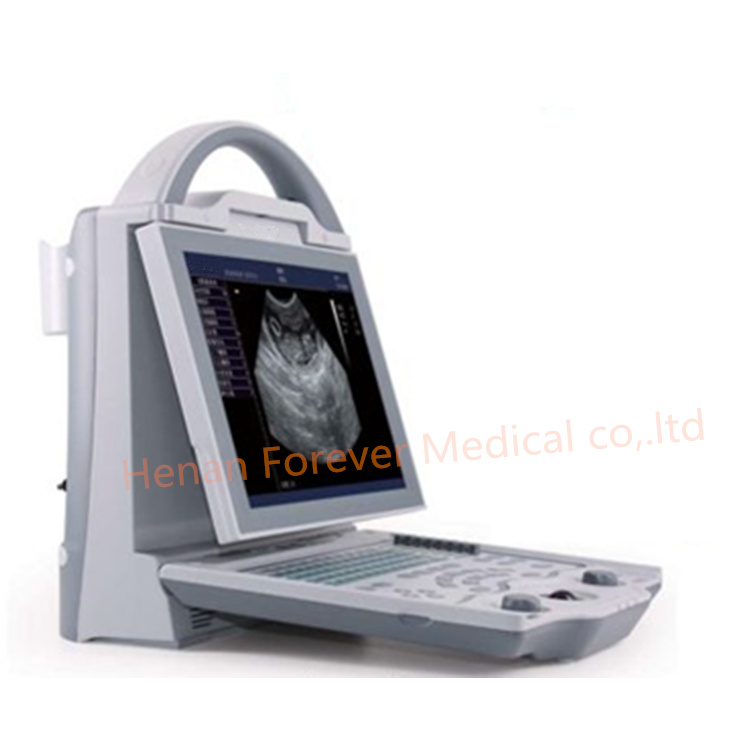 Newest Ultrasound Scanner Medical Scanner for Patient (YJ-U5600)