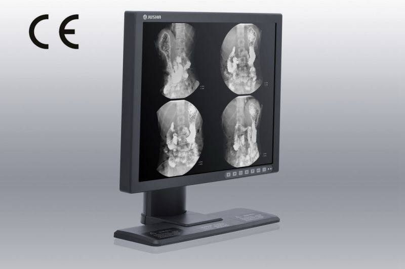 19-Inch 1MP 1280X1024 Monochrome Monitor for X Ray Medical Device, CE,