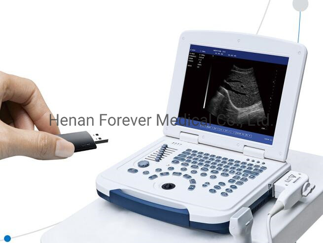 Medical Laptop B/W Portable Ultrasound Scanner for Abdomen