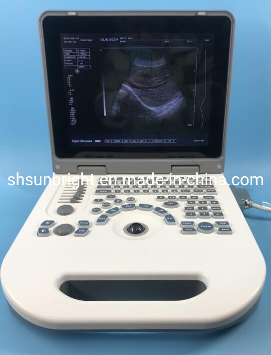 Laptop Scanner Ultrasound Best Price Ultrasound with 2 Probe Connectors