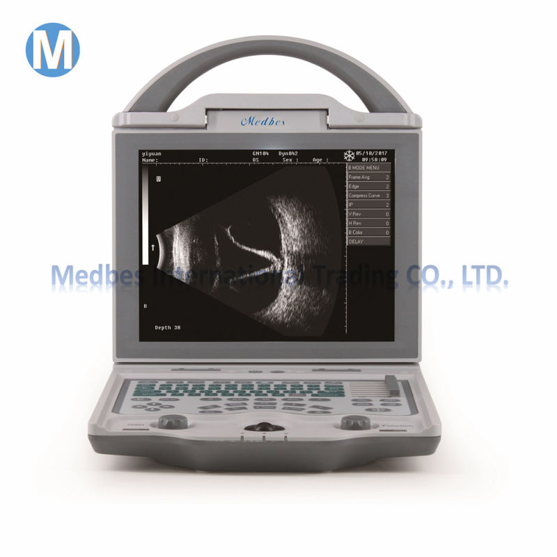Ophthalmic Ultrasound a B Scan Medical Equipment for Eye Test