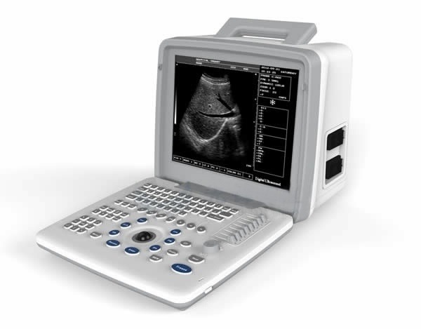 Portable B/W Ultrasound Scanner with Clear Image Quality Medical Equipment