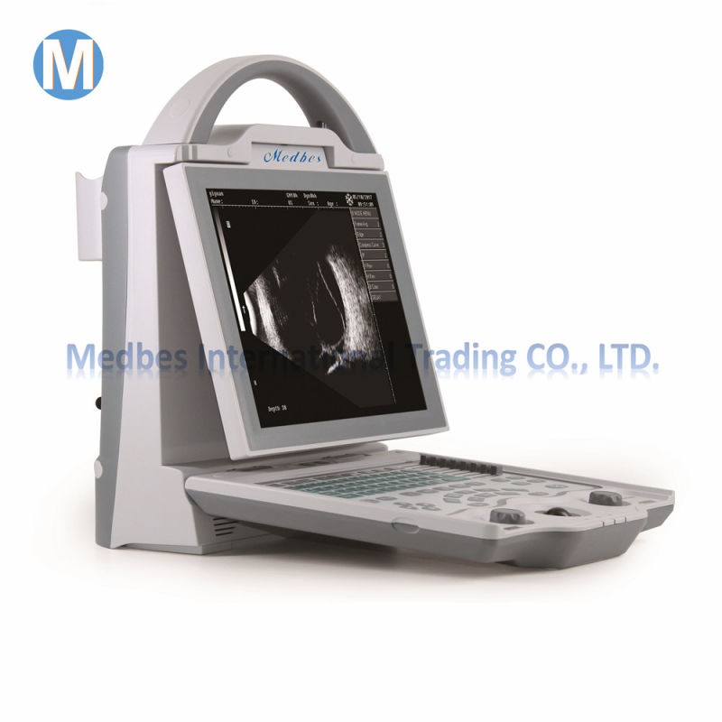 Hot Sale Medical Equipment a Scanner Eye Scanner Ophthalmic