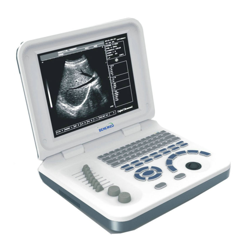 Notebook Type Black and White Ultrasound Scanner Medical Equipment