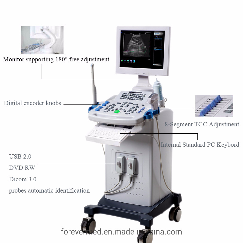 Trolley 3D Color Doppler Ultrasound Scanner Ultrasonic Scanner