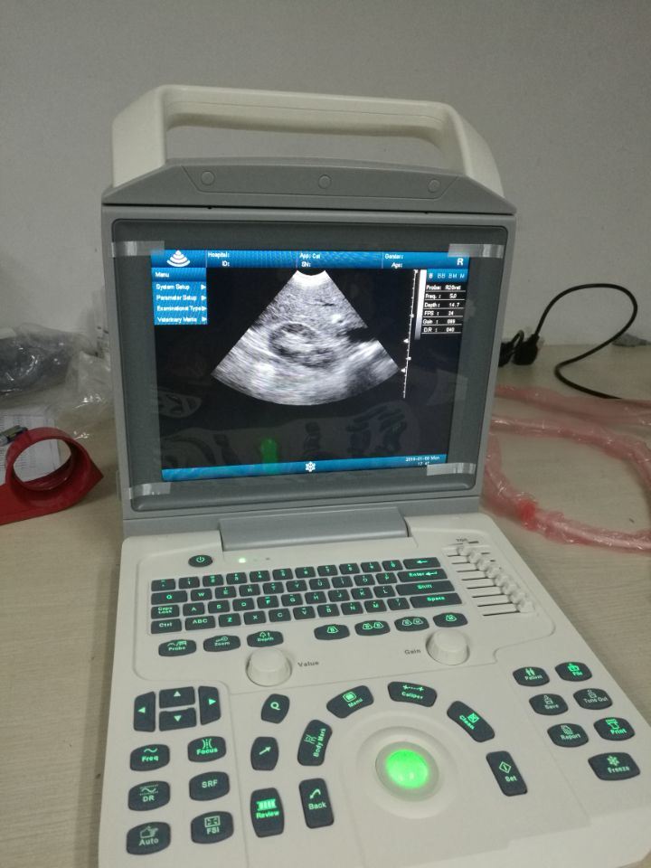 Hot Sales Clinical Doppler Ultrasound Scanner Mslpu46/ Handheld Ultrasound Scanner