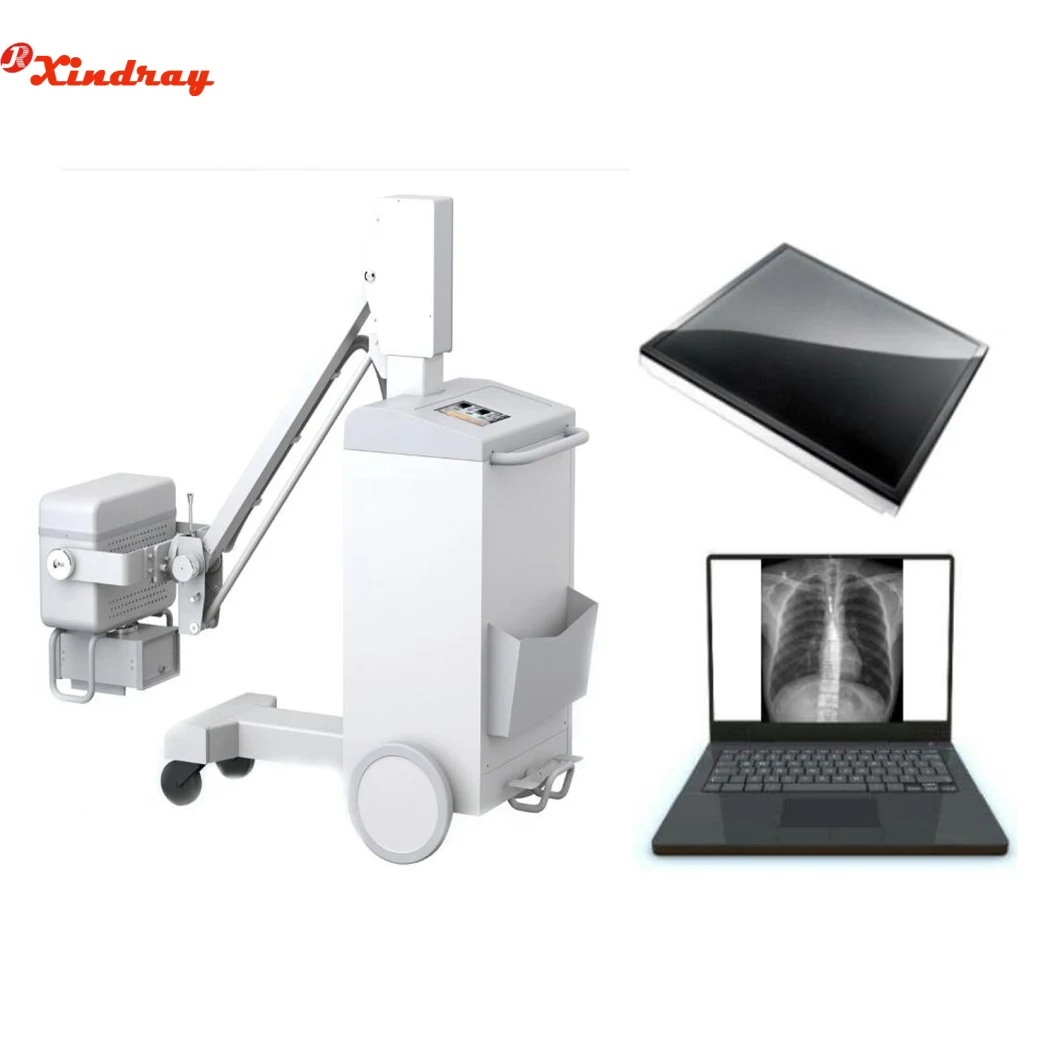 Medical Equipment Mobile X-ray Radiography High Frequency Mobile Digital Portable X Ray Machine