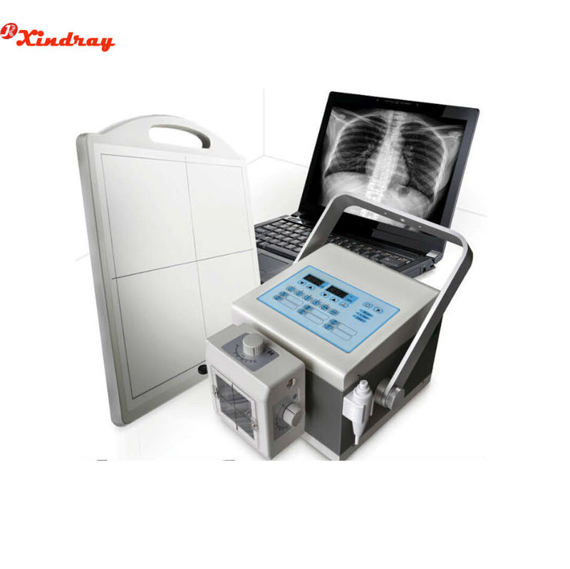 Hospital Equipment 5kw 100mA Mobile X-ray Machine