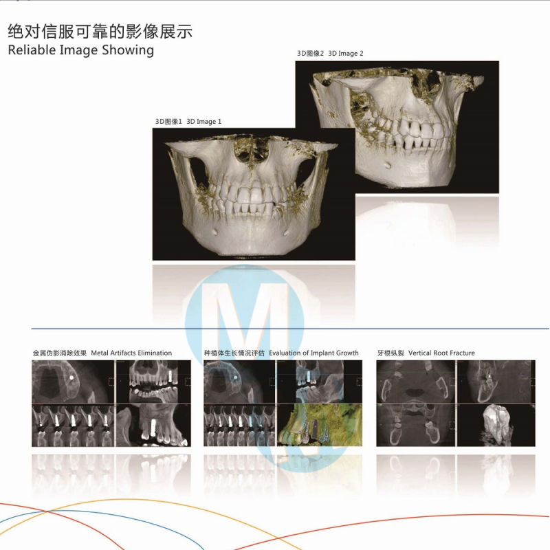 Digital Dental X-ray Unit 3D Dental X Ray